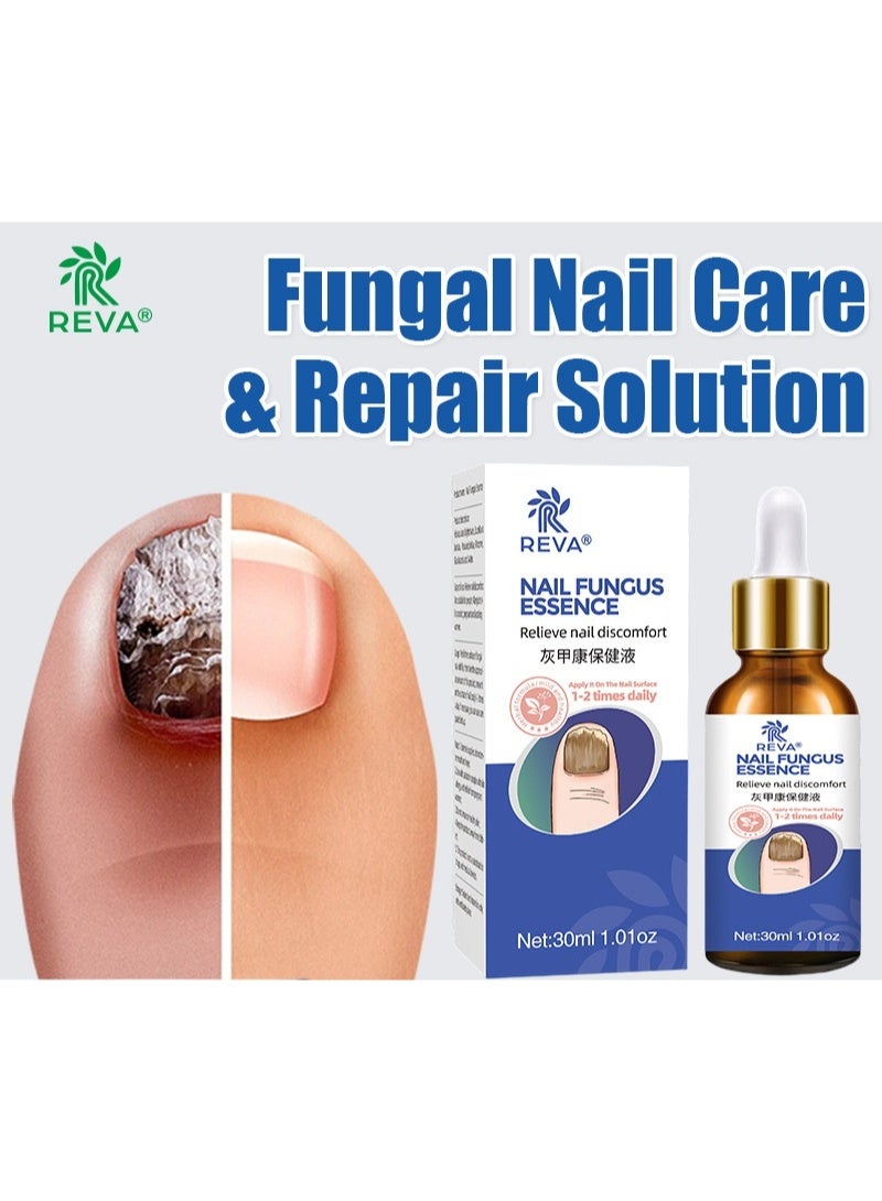 ريفا محلول ريفا لعلاج فطريات الأظافر ومضاد للبكتيريا: إصلاح احترافي موجه، اختراق عميق، يحسن مشاكل فطريات الأظافر (30 مل) - Image 1